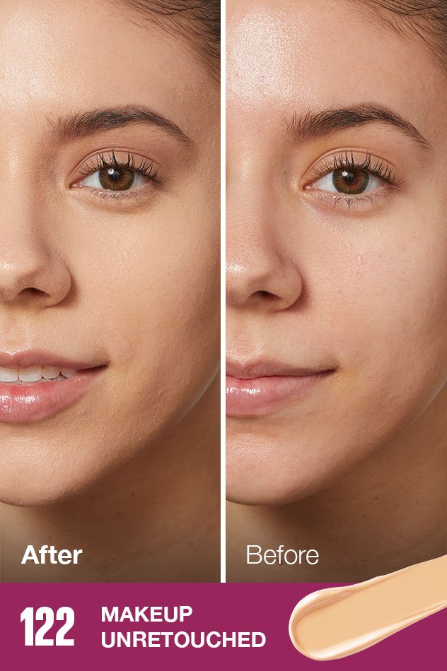 IARConcealer US BeforeAfter 122 632x950